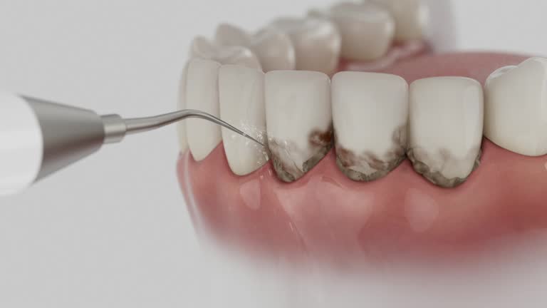 Trusted Invisalign Clear Aligners service in Compton, CA - Dentist Open Now